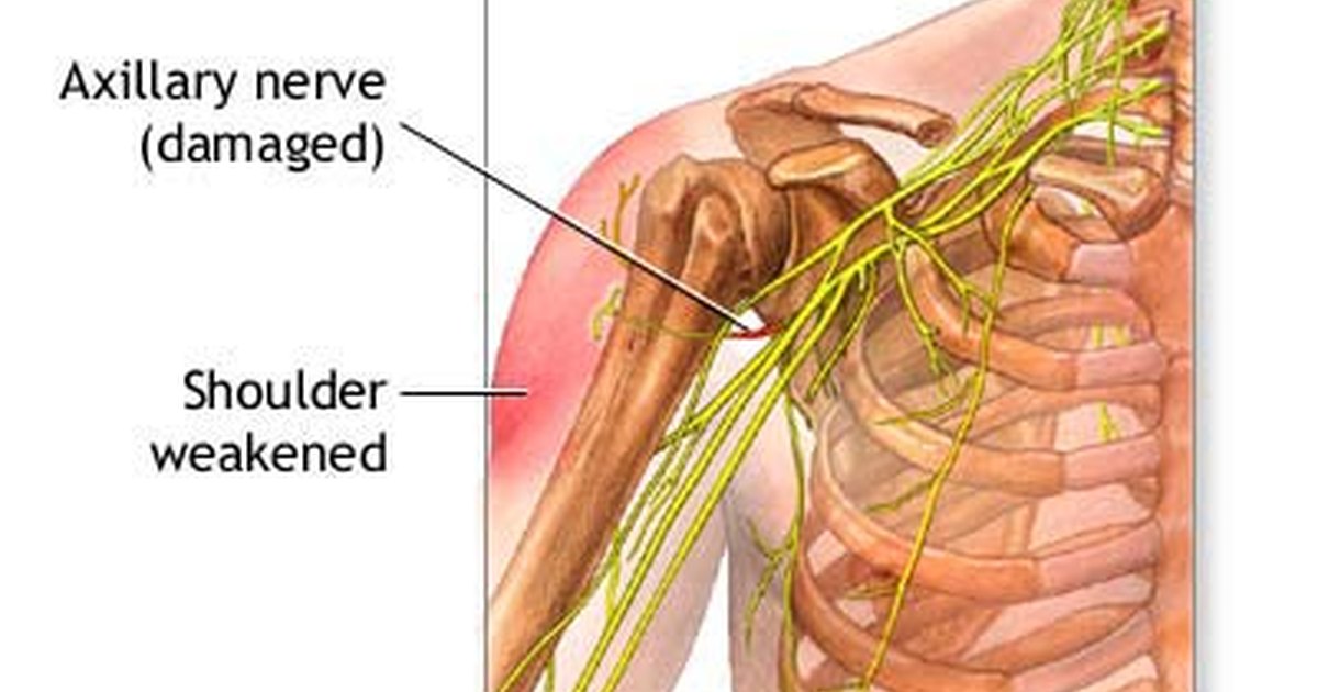 shoulder-nerve-damage-symptoms-ehow-uk