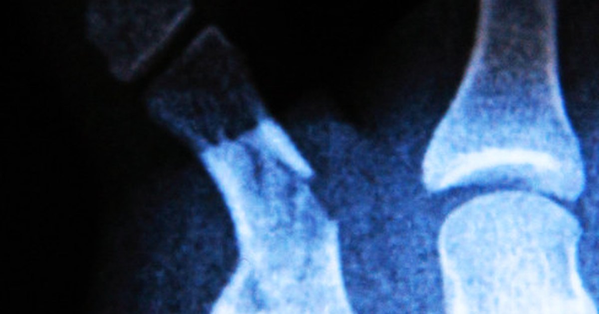 the-signs-of-a-broken-tailbone-ehow-uk