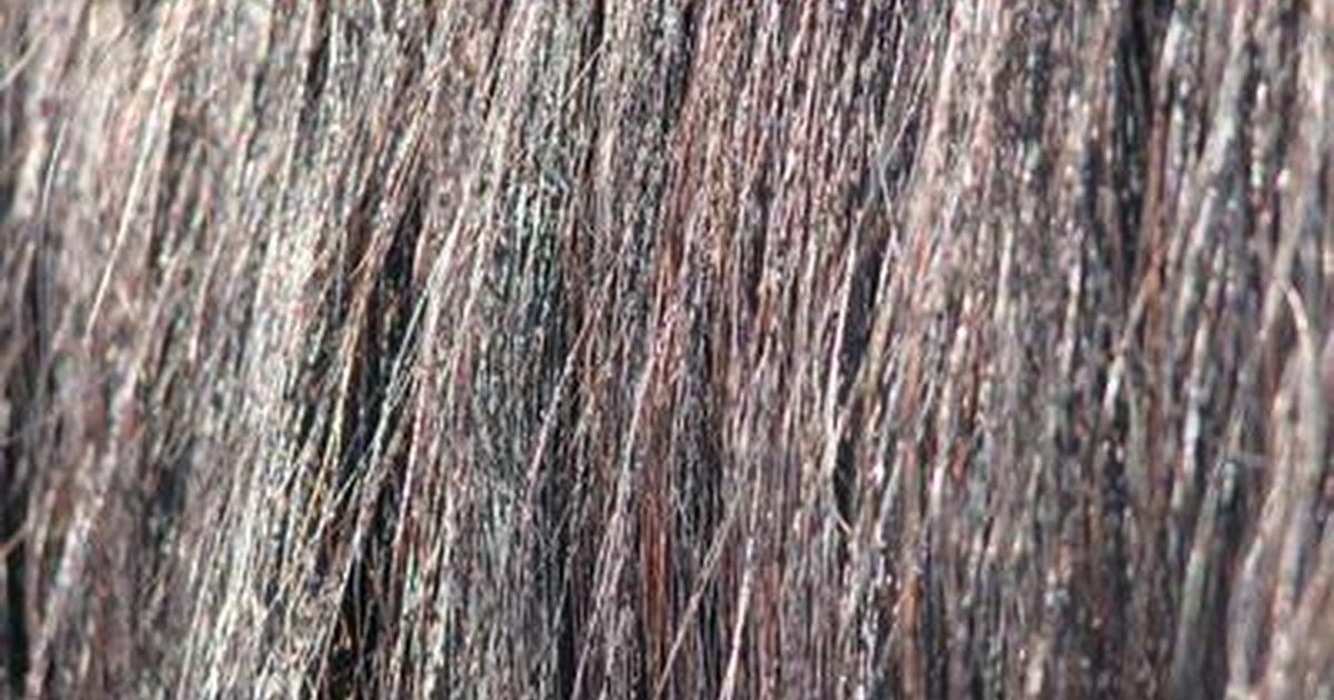 A que edad comienza la alopecia a los hombres