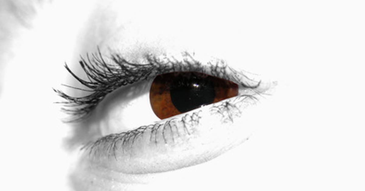 what-are-the-causes-of-brown-spots-in-the-eye-ehow-uk