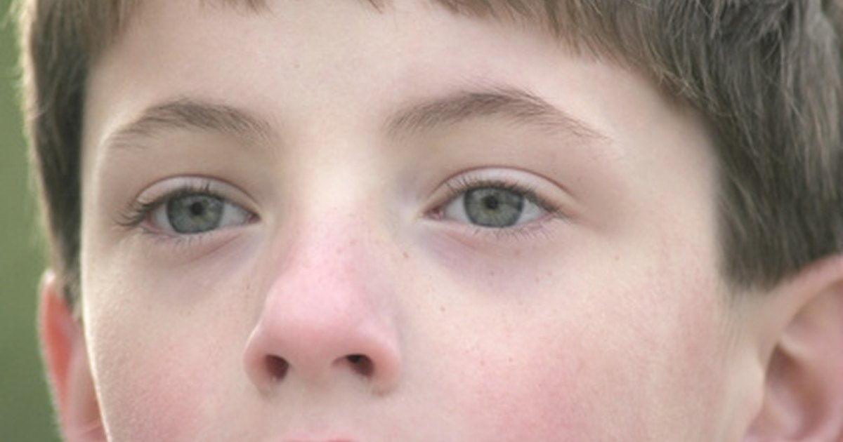 De la crema para la desaparición de las ojeras
