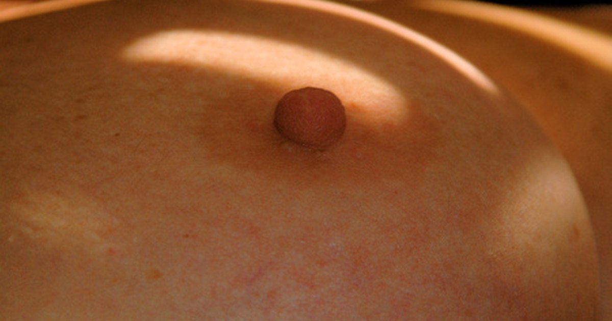 Lump Under Nipple 8