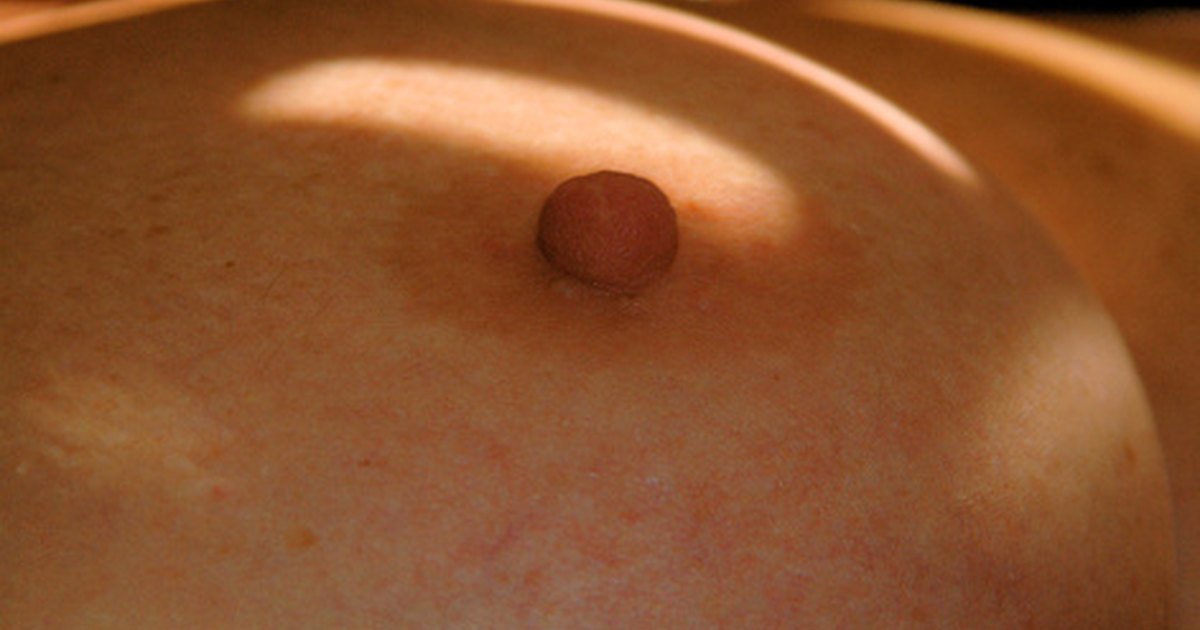 Lump On Nipples 54