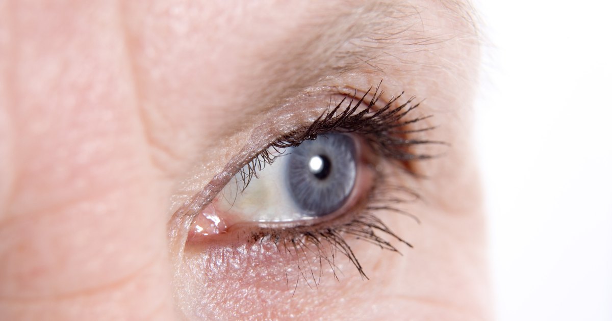 La mesoterapia de la persona arregla las arrugas