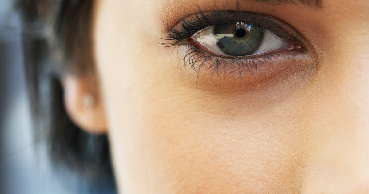 Como librarse de los cardenales y las ojeras oscuras