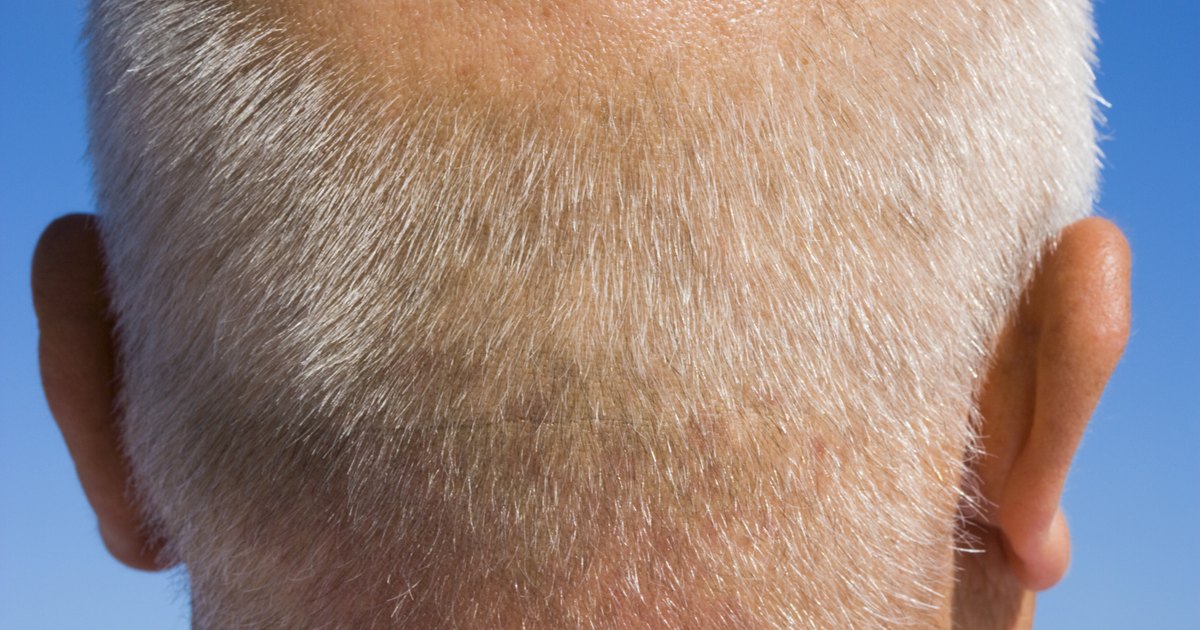 De la psoriasis sobre la persona la medicina el ungüento
