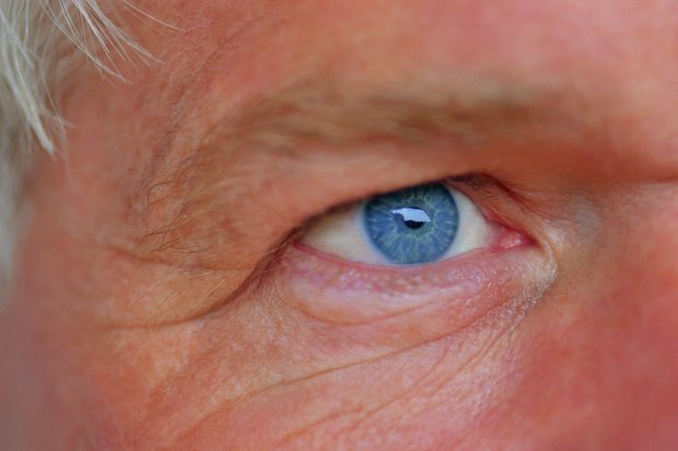 La máscara para la persona de las arrugas de edad