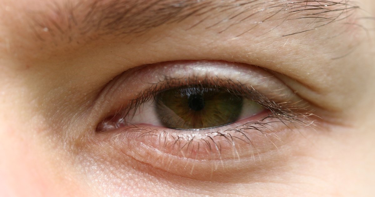 Scratched eye symptoms | eHow UK